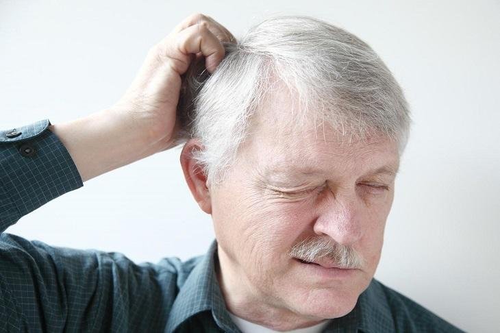 Beim bewegen kopfhaut tut weh haare Nervenschmerzen der